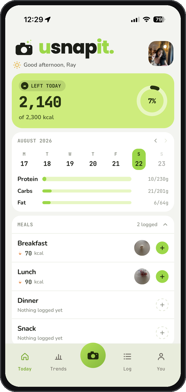 The usnapit Today screen: 2,140 calories left of 2,300, the week strip, macro bars and the day's logged meals as photos